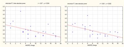 Baseline Difference in Quantitative Electroencephalography Variables Between Responders and Non-Responders to Low-Frequency Repetitive Transcranial Magnetic Stimulation in Depression